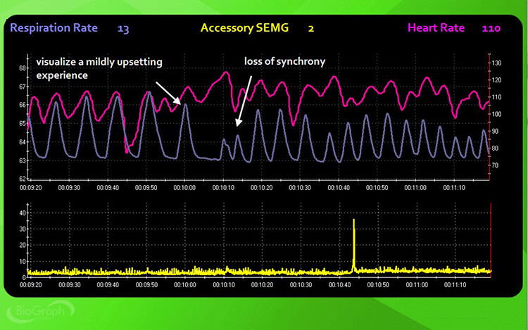 visualization stressor